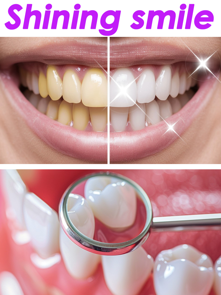 Teeth Whitening Xylitol - GlorySmile-productos de pasta de dientes afrutada