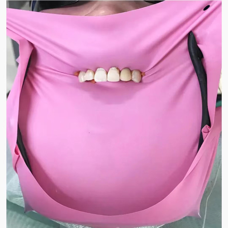 Hojas de dique de goma Dental, - Teeth Whitening Naturally reseña y precio
