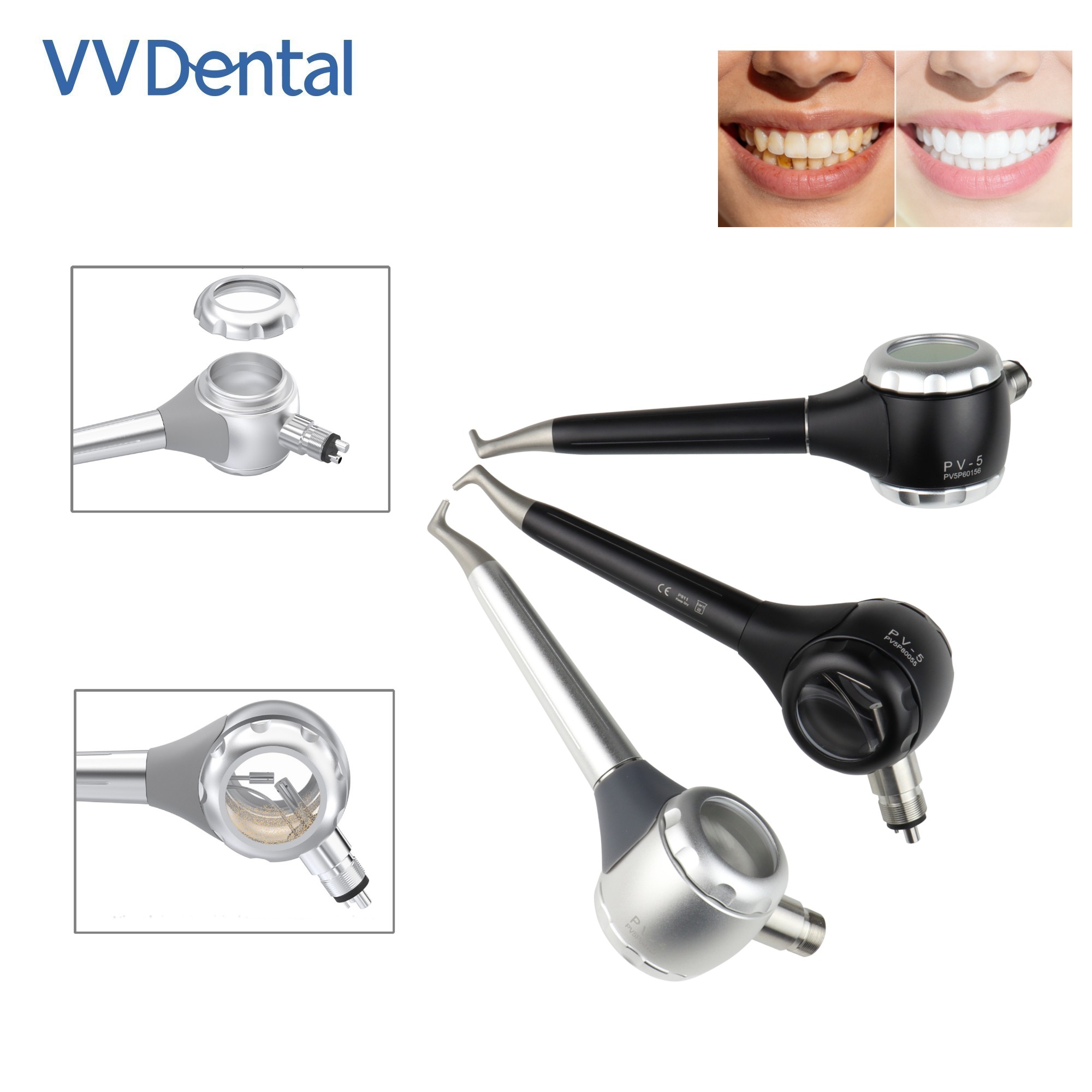Pistola de arenado dental VV d - Teeth Whitening Free reseña y precio