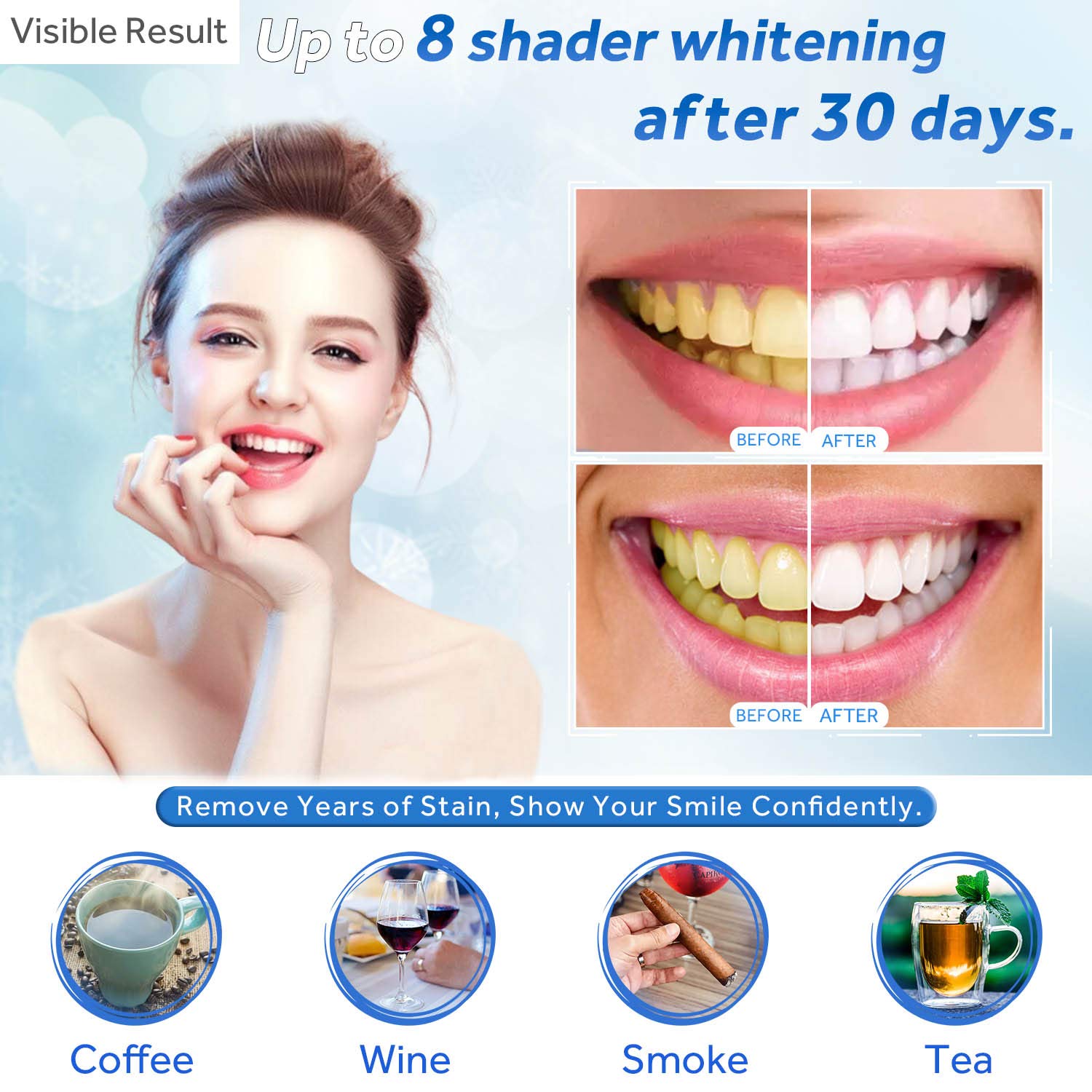 Jeringa de repuesto de Gel par - Teeth Whitening Ai reseña y precio