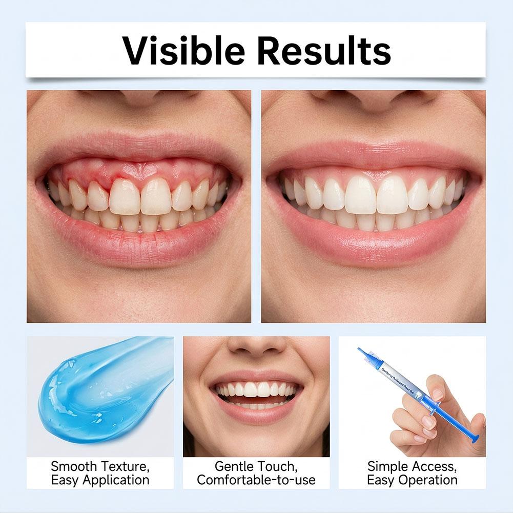 Gel reparador periodontal para - Teeth Whitening Gel Syringes reseña y precio