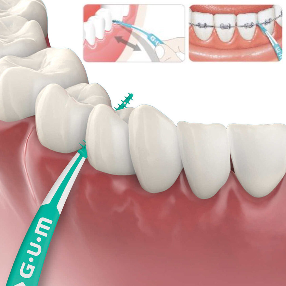 Cepillo de limpieza Interdenta - Teeth Whitening Japan reseña y precio