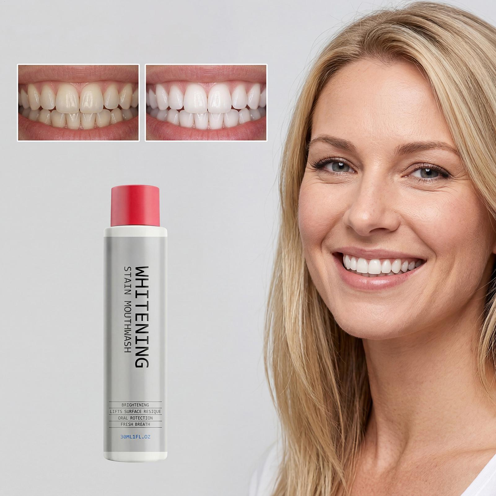 Enjuague Bucal Blanqueador de  - Teeth Whitening And Stain Removal reseña y precio