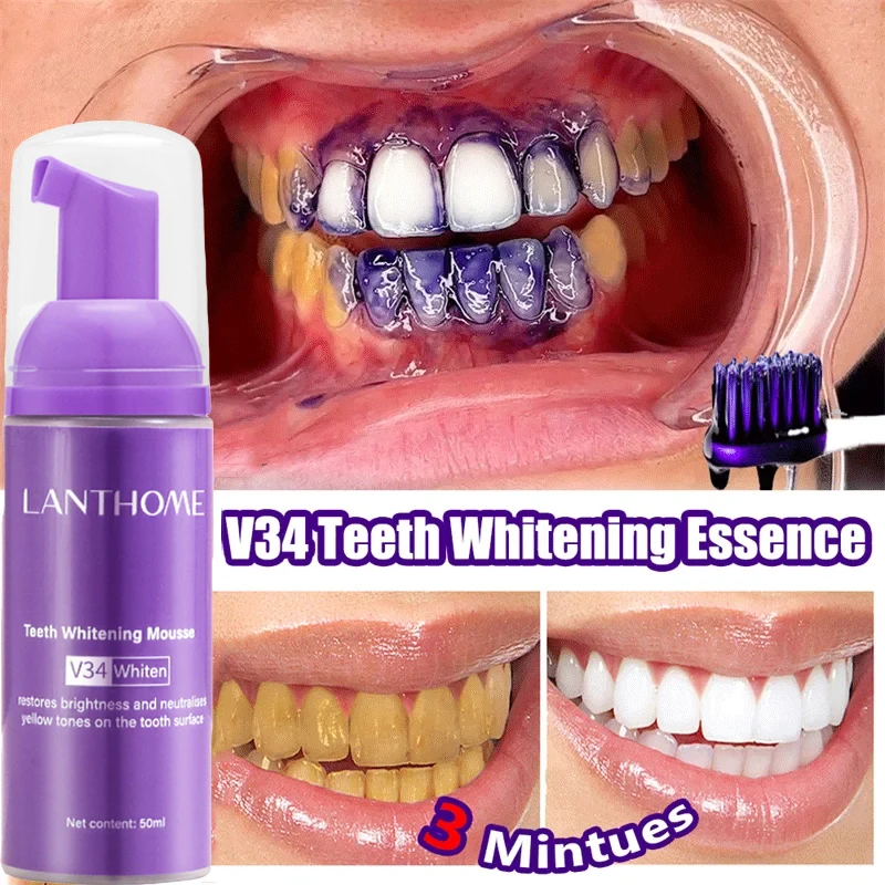 V34 blanqueamiento Dental Mous - Teeth Whitening Xylitol reseña y precio