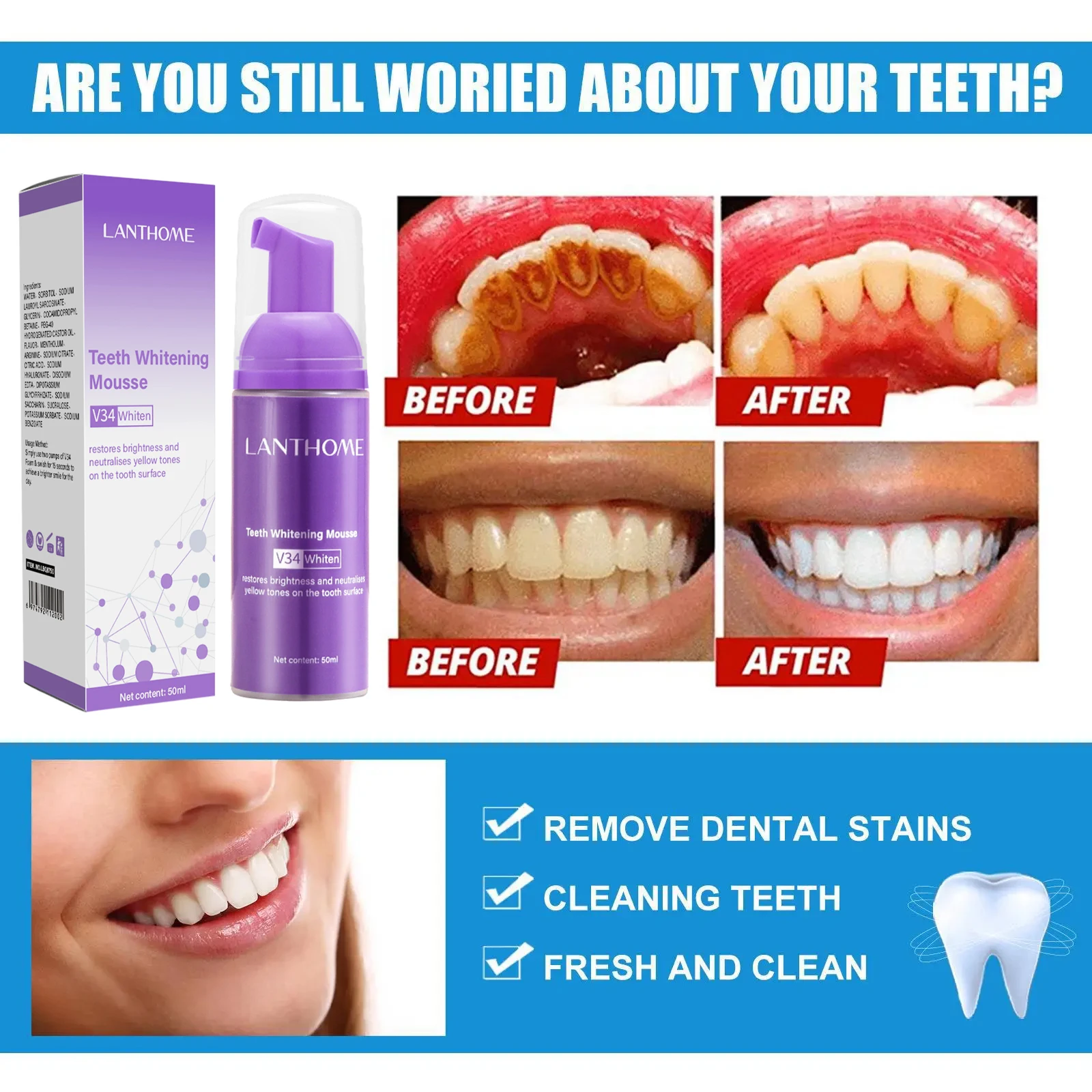 V34 blanqueamiento Dental Mous - Teeth Whitening Xylitol reseña y precio