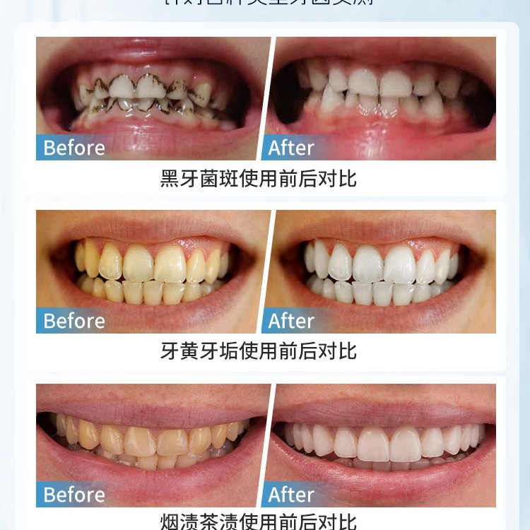 Cepillo de eliminación de manc - Teeth Whitening Japan reseña y precio