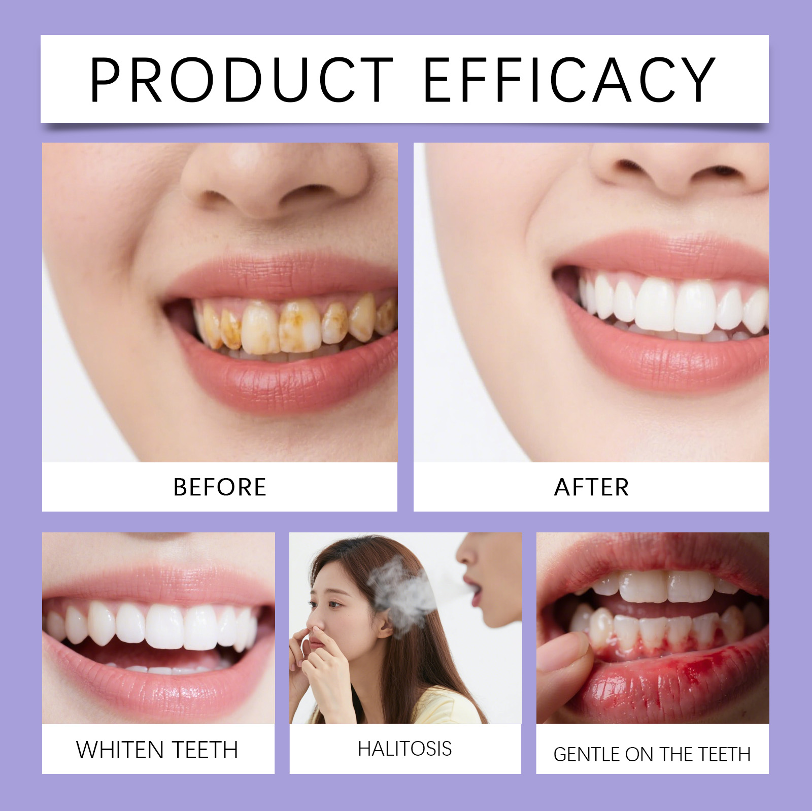 Enjuague Bucal Morado con Sabo - Teeth Whitening Xylitol reseña y precio