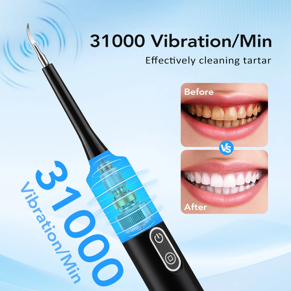 Limpiador Dental Eléctrico con - Teeth Whitening Naturally reseña y precio
